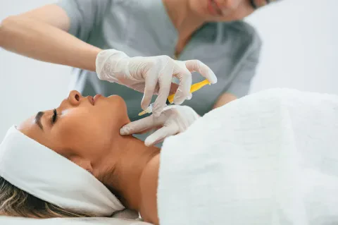 Vector lifting, non-surgical face lift with Radiesse