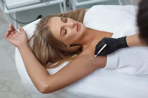 Treatment of hyperhidrosis