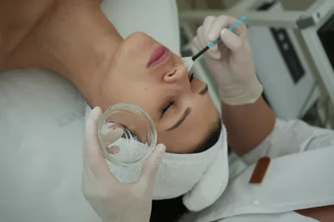 Retix C peeling
