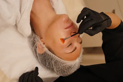 Retix C peeling