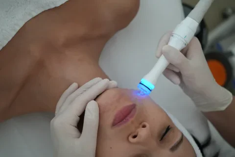 Aquapiling, cleaning, dermabrasion